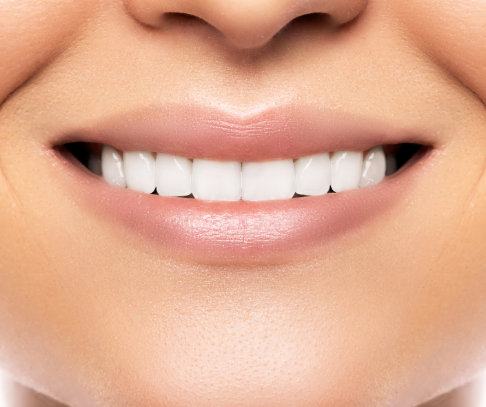 Teeth Whitening