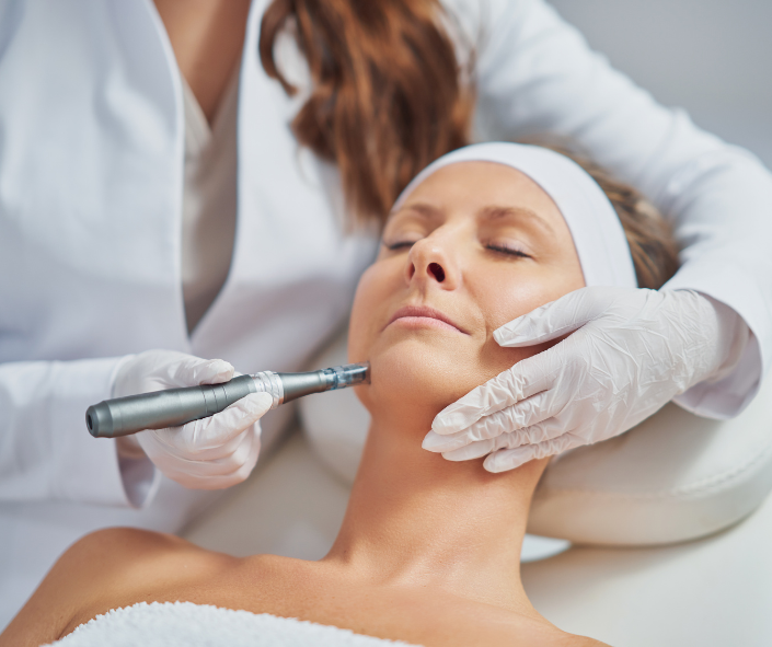 Microneedling
